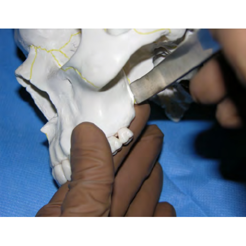 GDC Pterigoidous Chisel (PC)