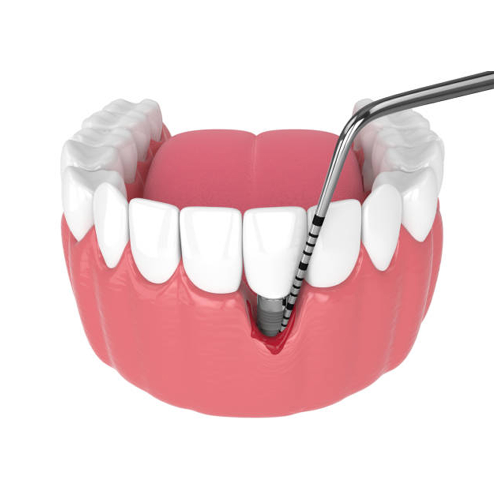 GDC Single End Probes University Of North Carolina #4 (Pcpunc15)