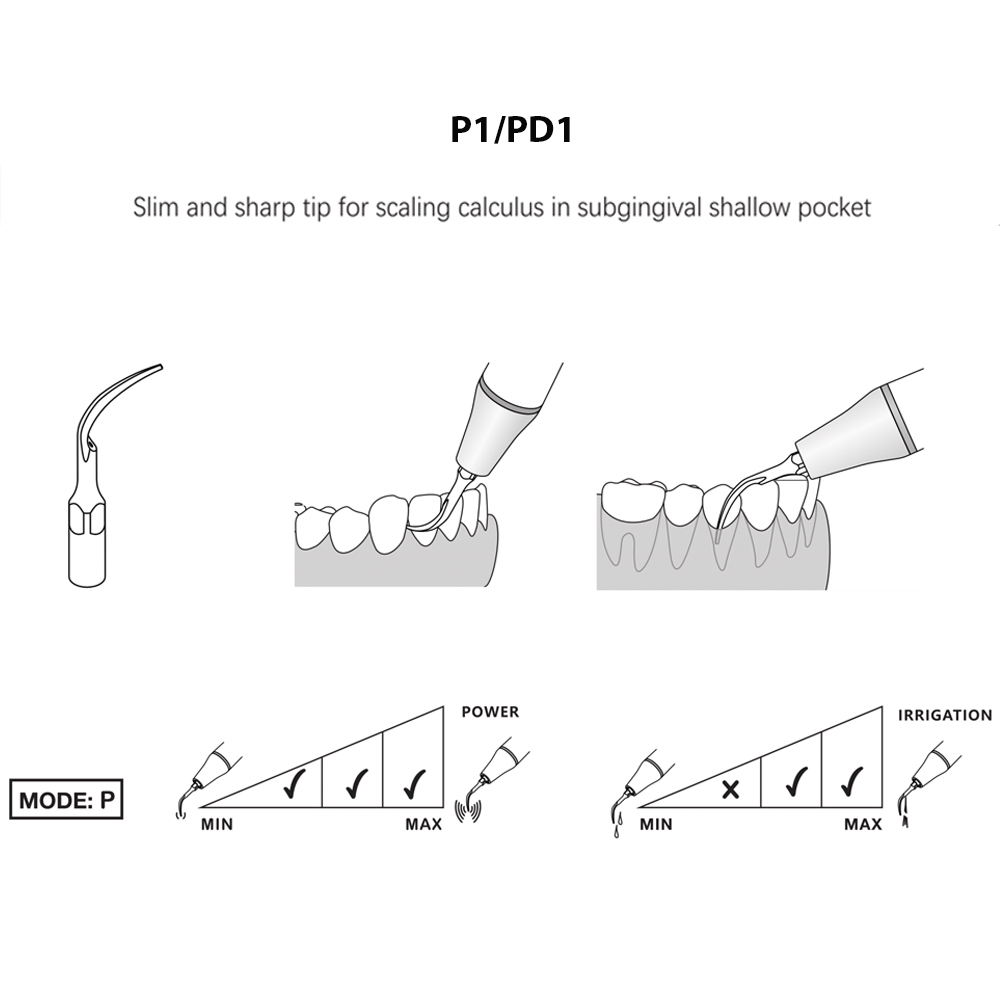 Woodpecker Scaler Tip PD1 for DTE & Satelec Scalers