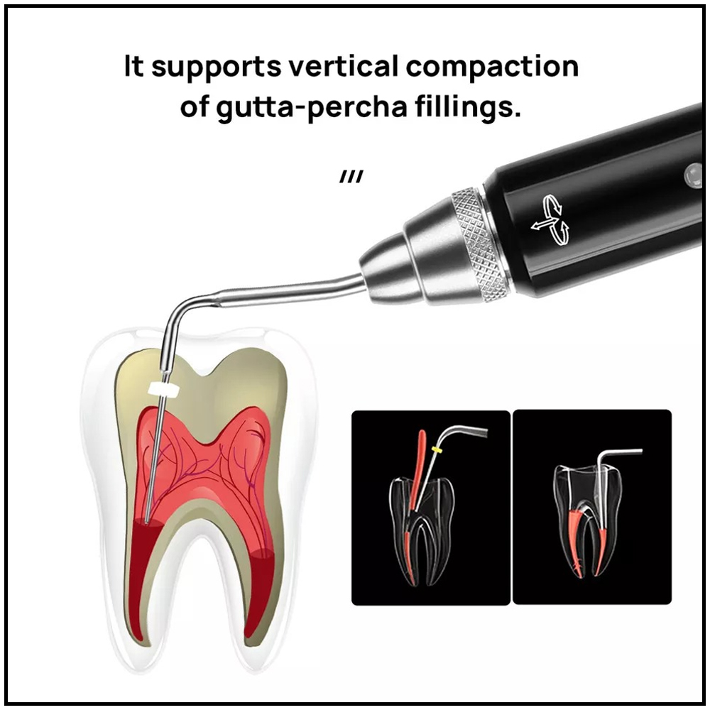 Woodpecker Fi-P Obturation Pen Tips (Pack of 1)