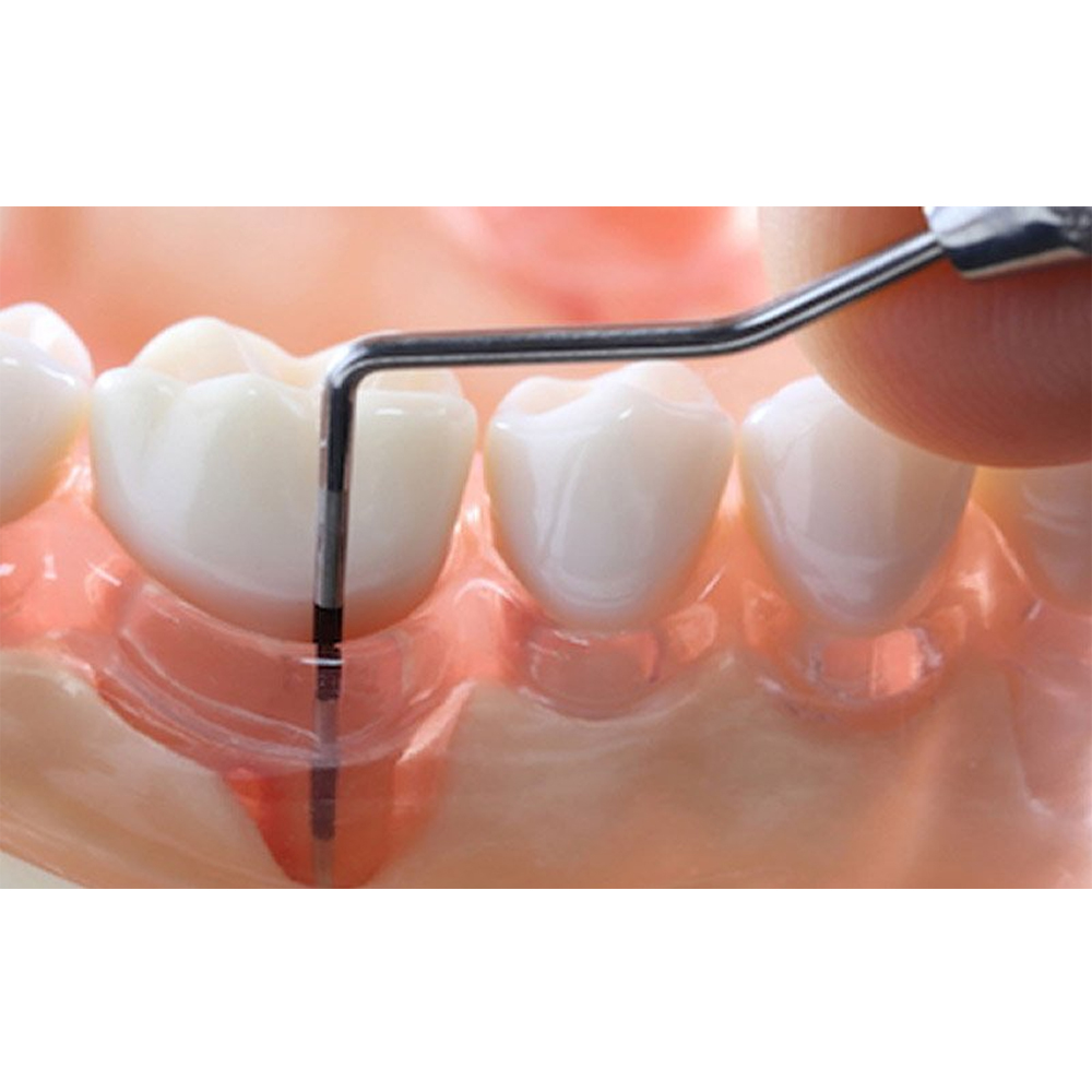 GDC Double End Probes Unc 15 / Screening Probe #1 (PCP15/11.5)