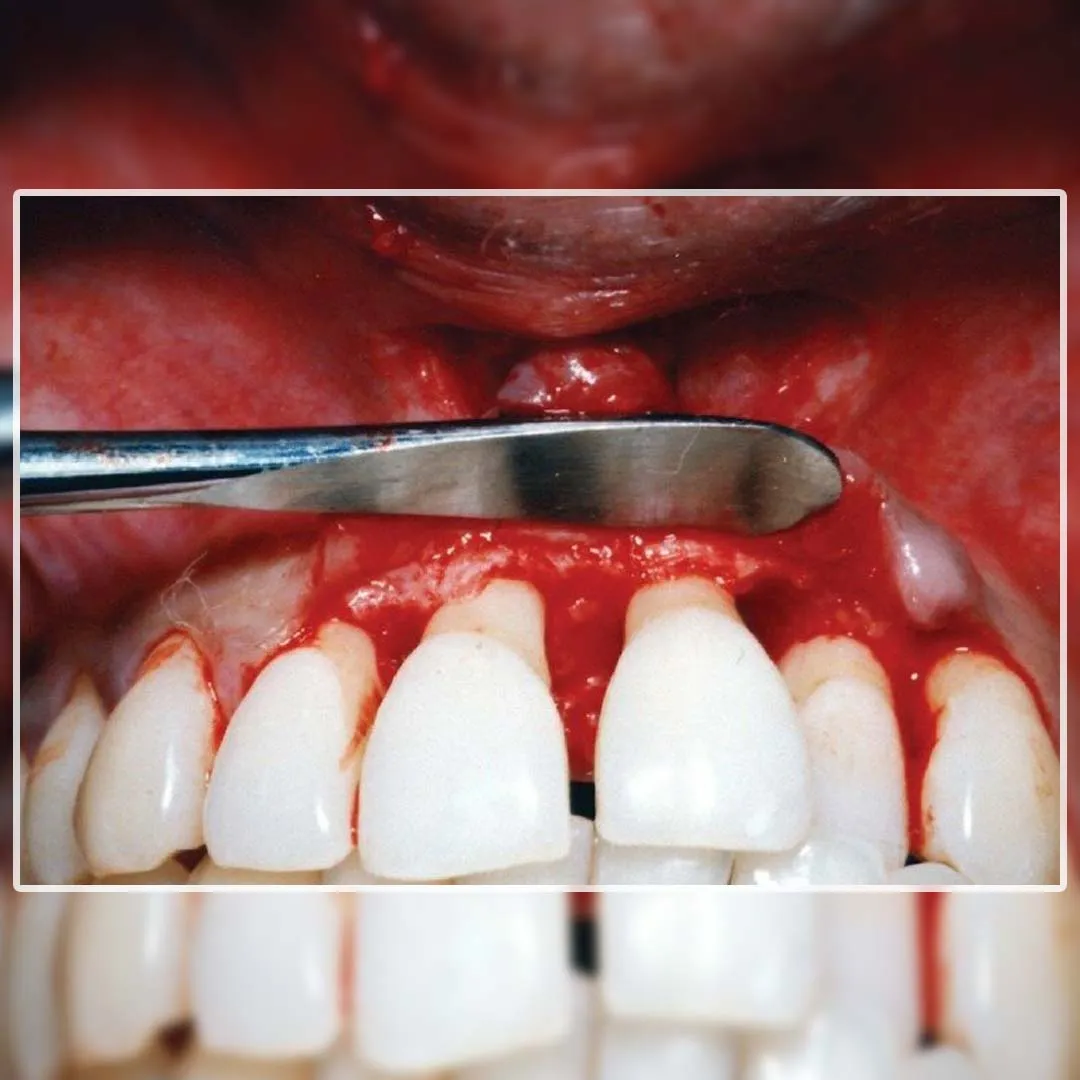Image Slide