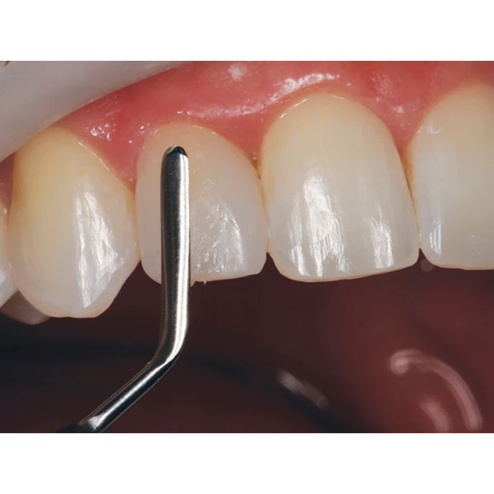 GDC Heidemann Spatula #6 (PFIHS2)