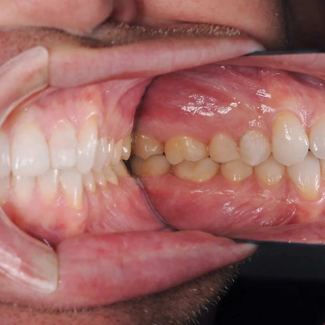 Hahnenkratt Photographic Mirrors with Handle