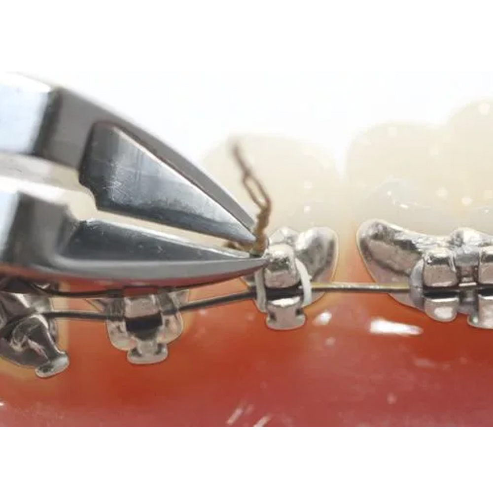 Koden Pin & Ligature Cutter (Euphoria League)