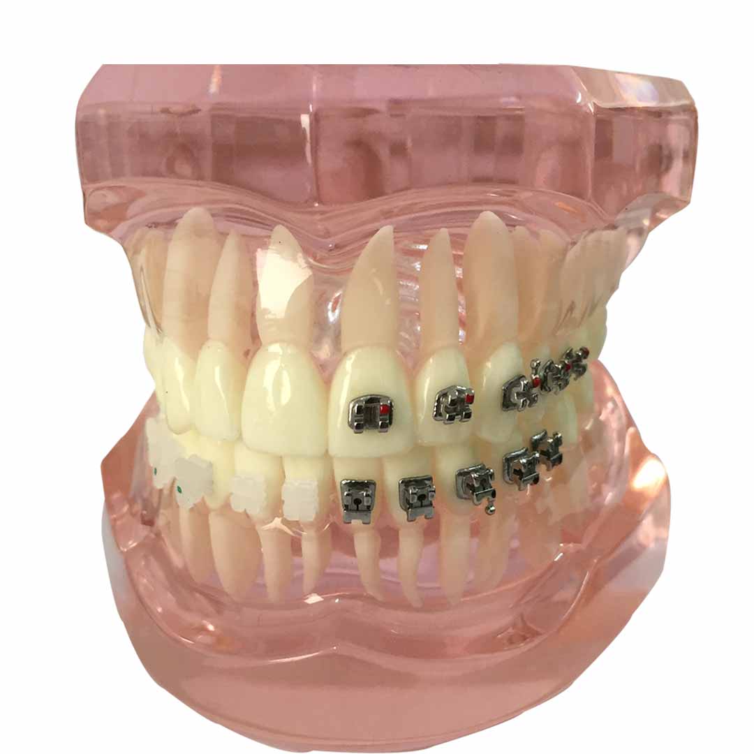 iDENTical Self Ligating Model M3012X Pink