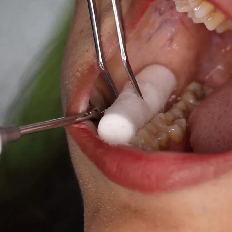 GDC Pmt Set Of 3 (PMTWC4)