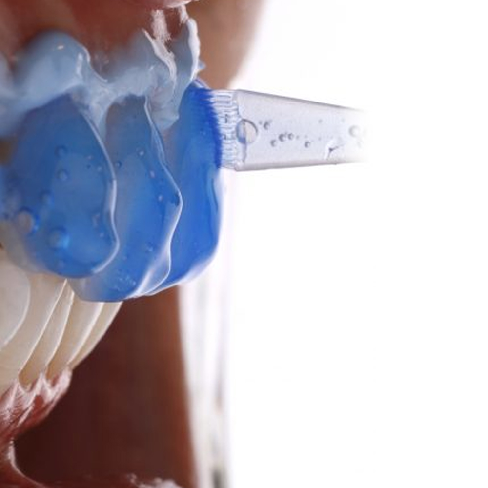 SDI Pola Rapid Advanced Tooth Whitening System