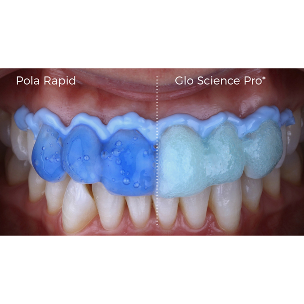 SDI Pola Rapid Advanced Tooth Whitening System