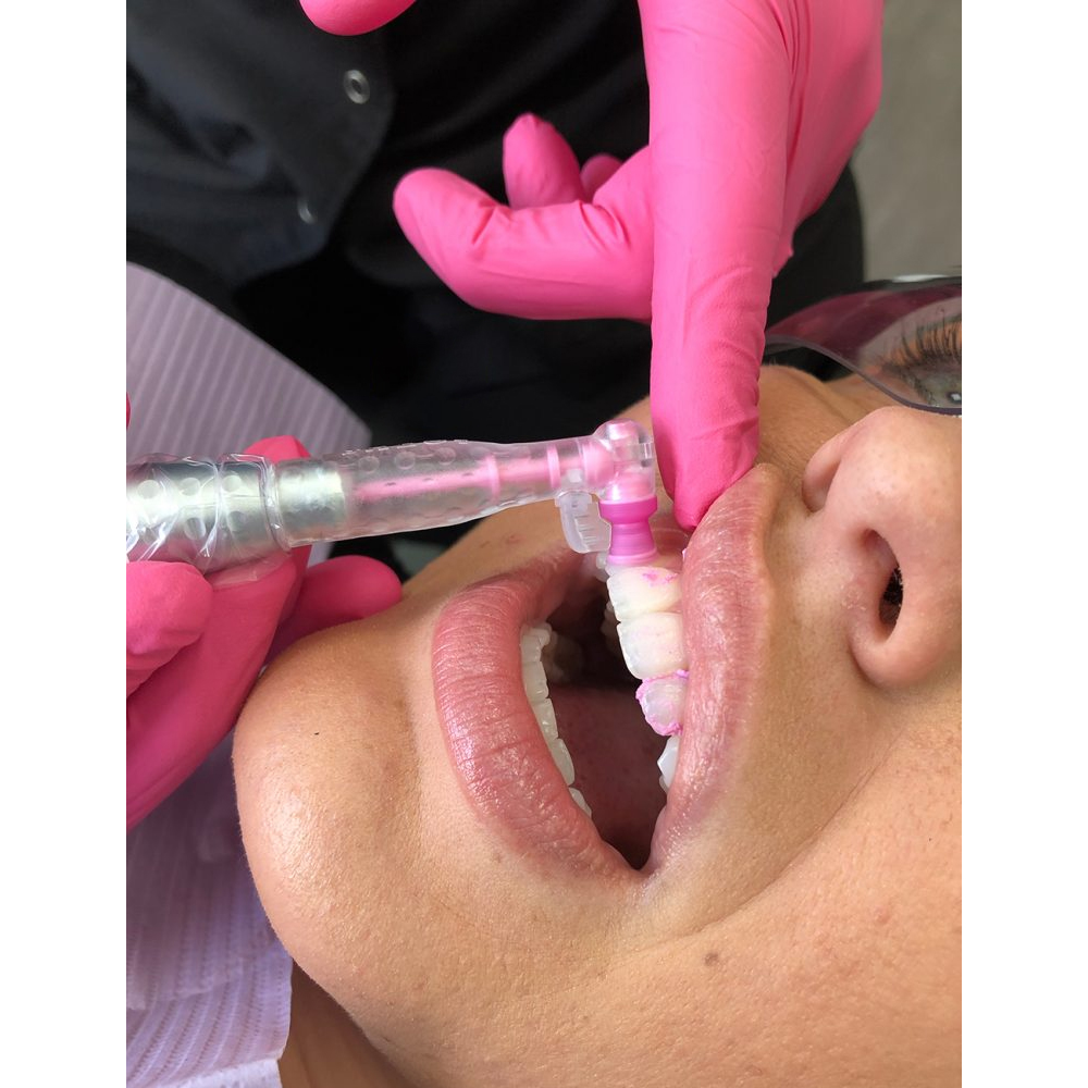 Vishal Dentocare VI ‐ Provil Prophylaxis Polishing Paste