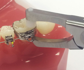 Waldent Posterior Band Remover Short TC 10/103