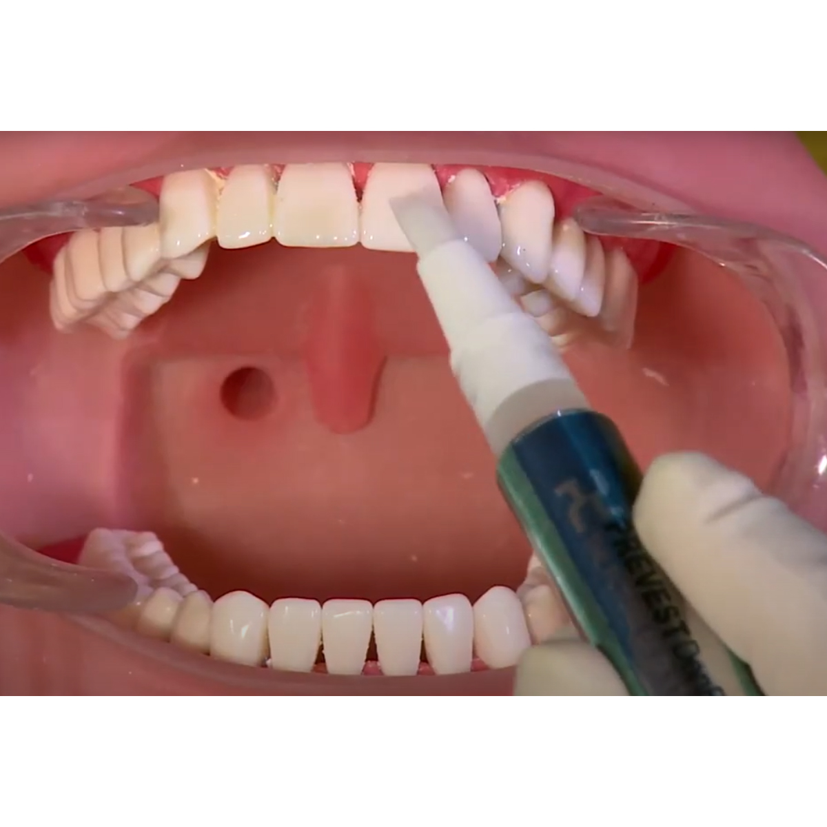 Prevest Denpro Bio Enamel