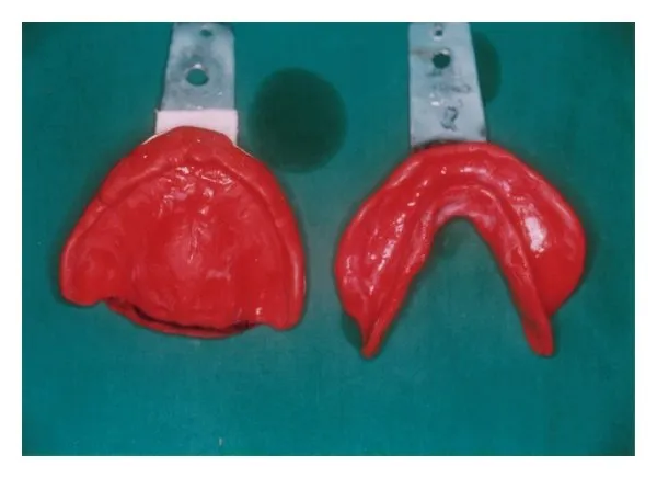 Rolex Impression Compound