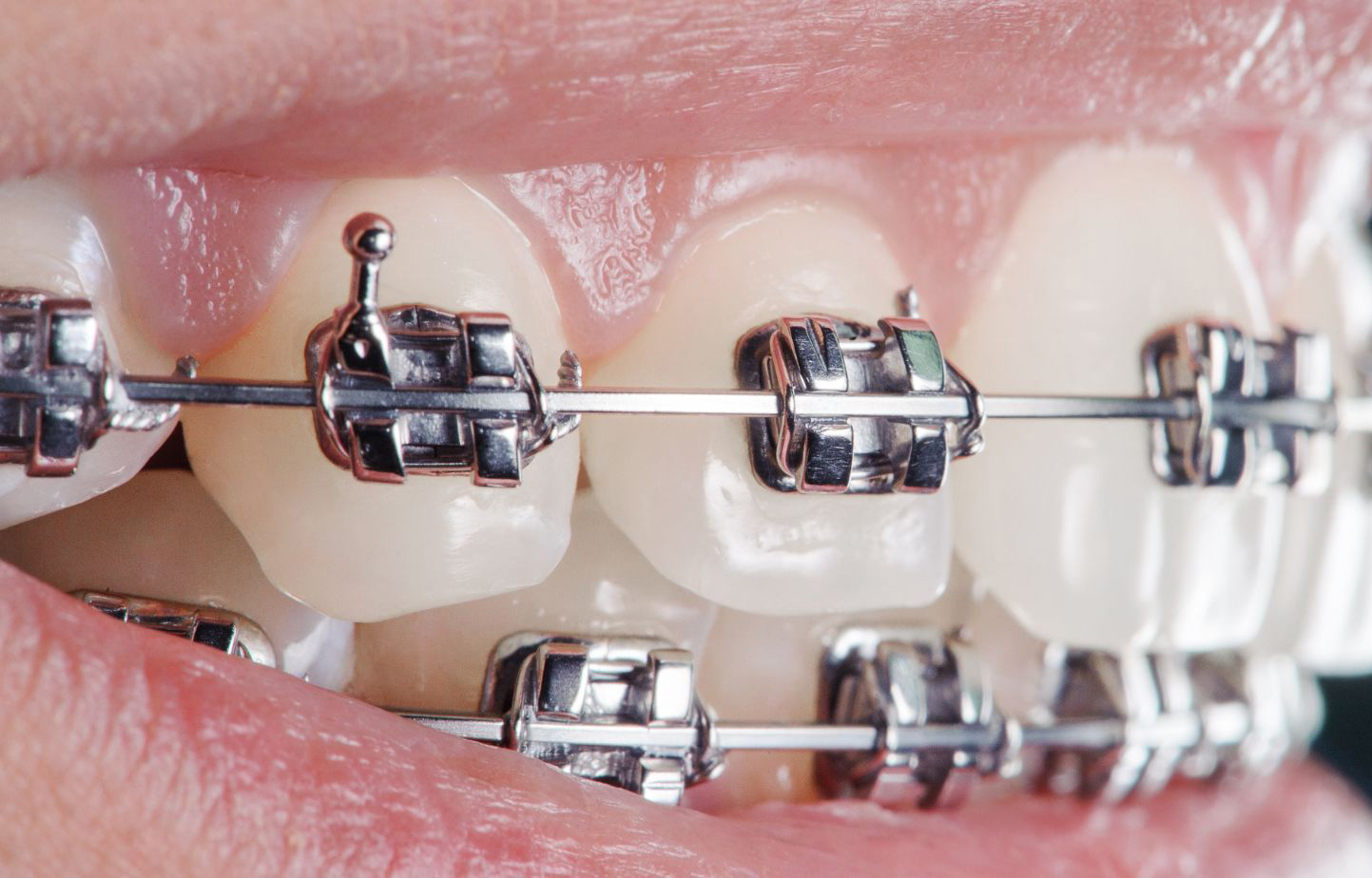 Phyx Preformed SS Archwire Rectangle (Pk of 10)