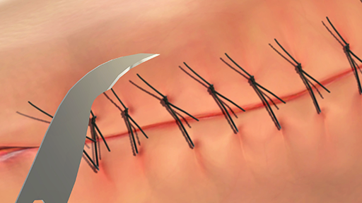 GDC Scissors Heath For Suture Cutting (15.5cm) (S25)