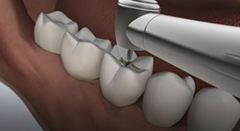 NSK Ti Max Z800L Handpiece