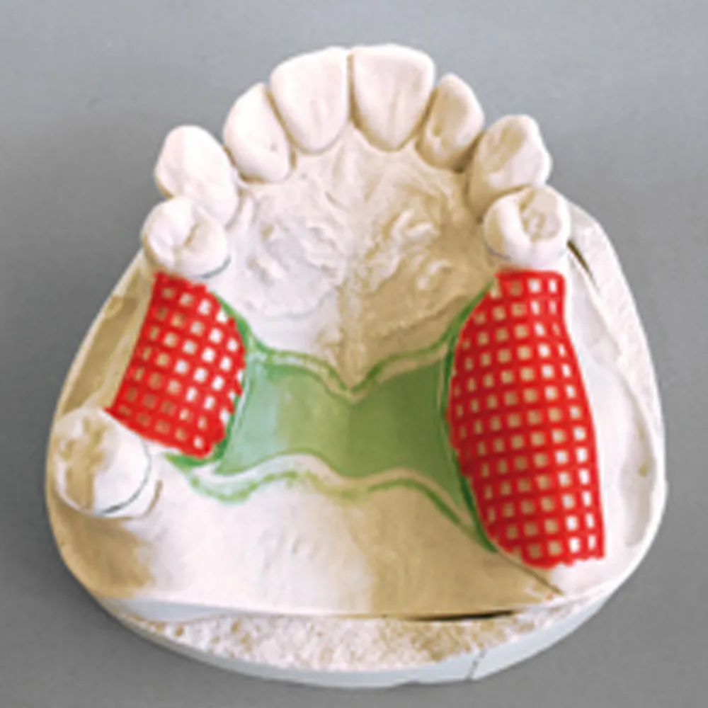 Dentaurum Waxes Retentions Red