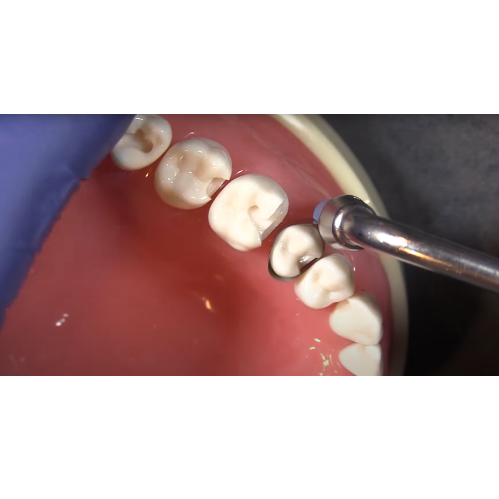 Garrison Dental ReelMatrix Tensioning Handle (RMH-100)  