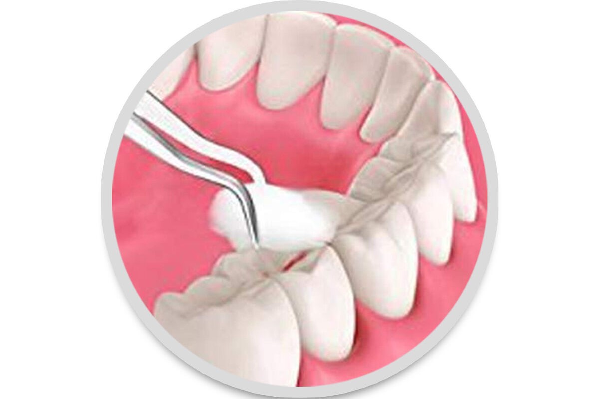 Oracraft London College Standard Tweezer - DPU17