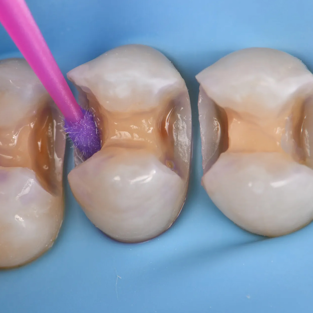 Kuraray Clearfil TRI-S Bond Universal Quick Bonding Agent