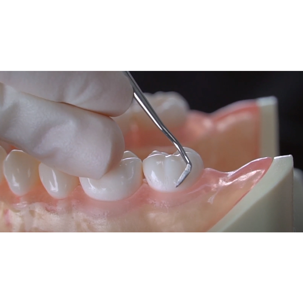 GDC Sickle Scalers Posterior #6 (Scnevi2)