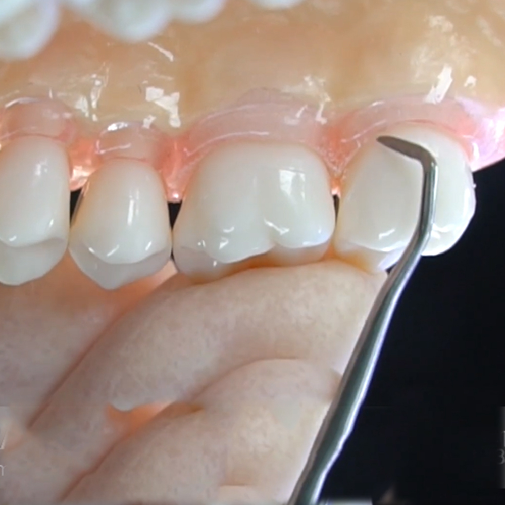 GDC Sickle Scalers Posterior #6 (Scnevi2)