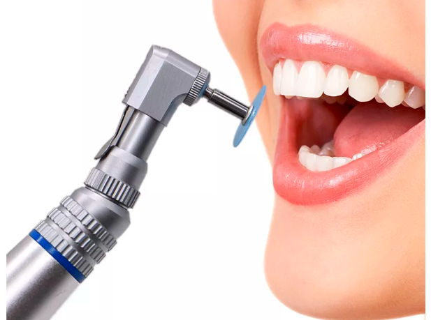 Tor Vm Finishing & Polishing Kit