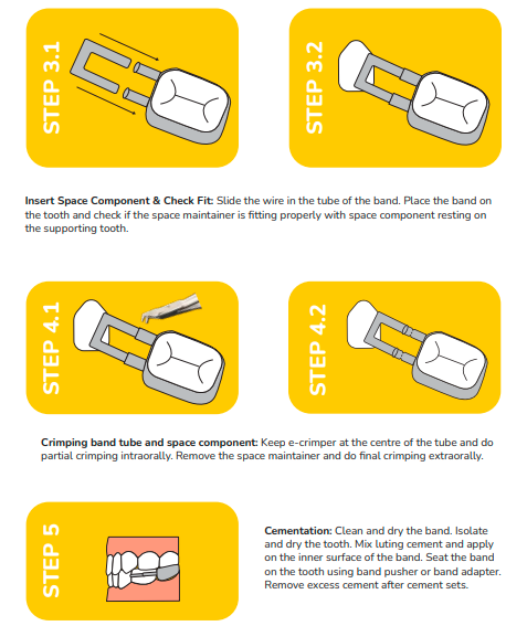 Kids-e-Dental Bands with tube attached Refills