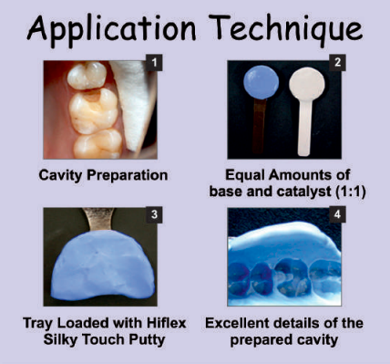 Prevest Denpro Accusil Combo Kit (70004-1)