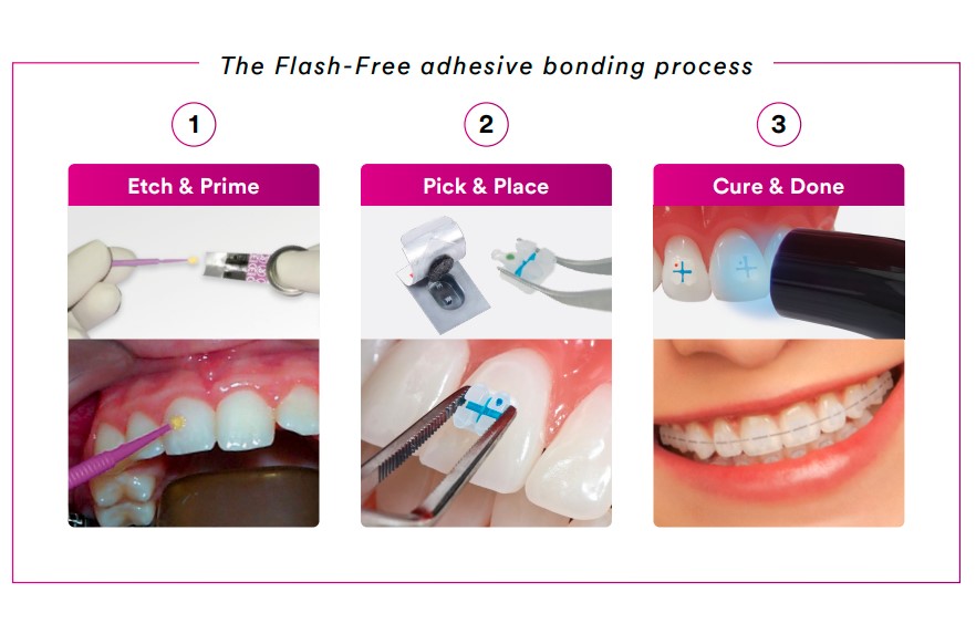 3m Unitek Clarity Advanced Ceramic Brackets