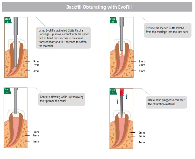 Diadent EvoFill Gutta Percha Cartridges