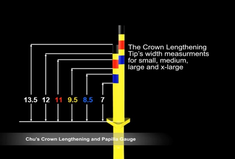 Hu-Friedy Chu'S Crown Lengthening Gauge (CLG)