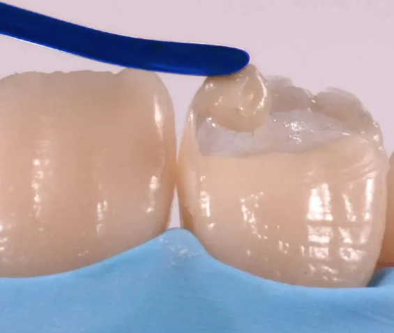 Oracraft Composite Instrument Blue Titanium Set Of 6 In Pouch - CIBS6