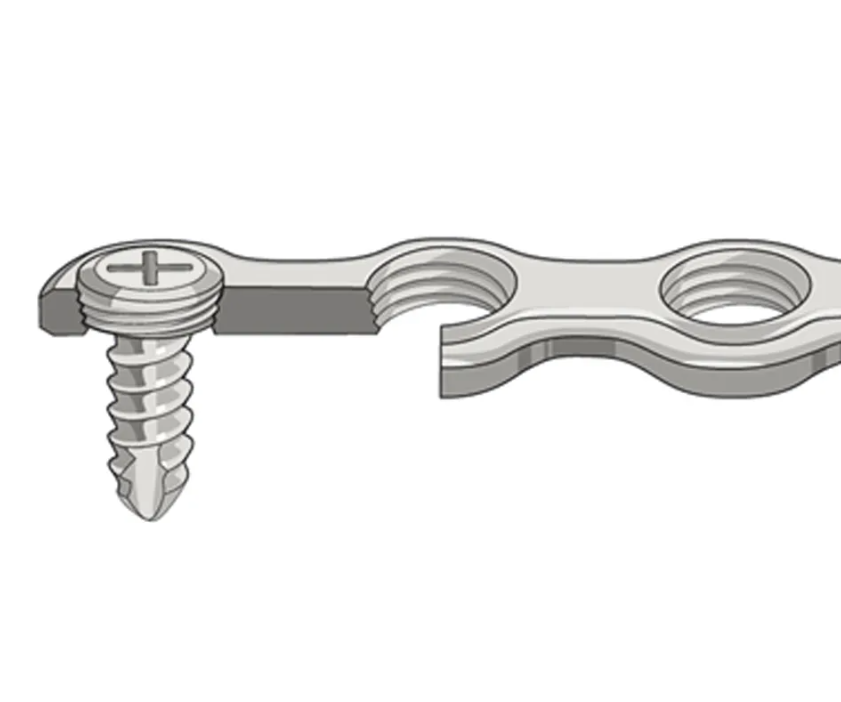 SK Surgicals SS Single Slot Screws - 2mm