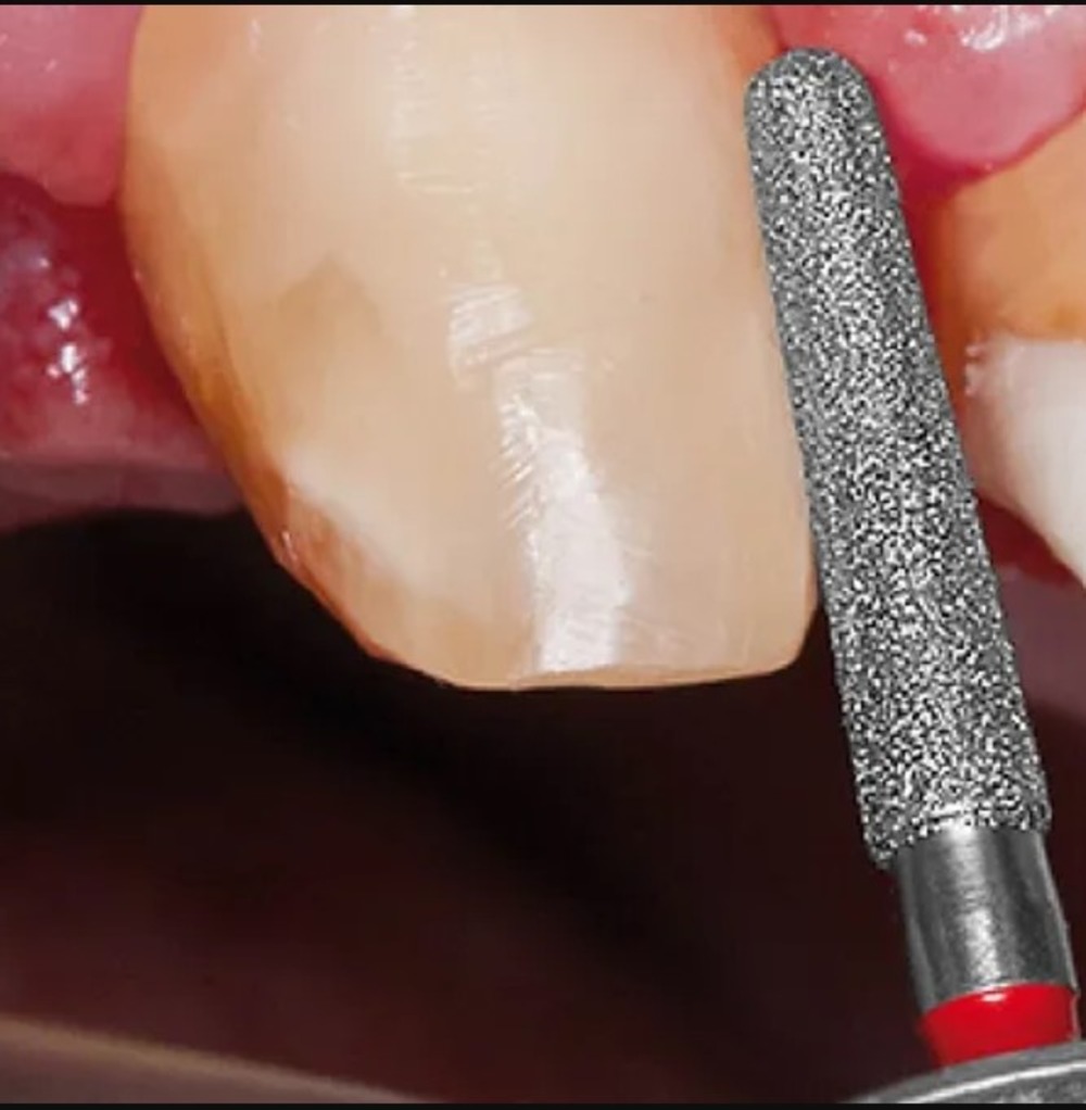 Mani Diamond Burs - Cr Polishing Series