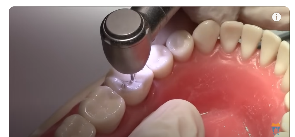 NSK Ti Max X600L Standard Head Airotor Handpiece (Optic)