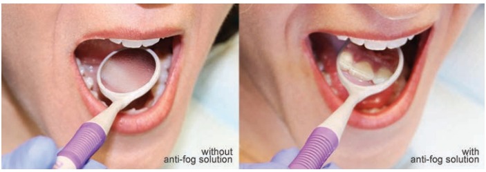 Prime Dental NT Fog 100ml