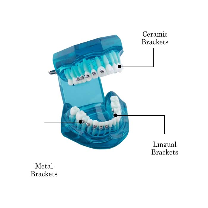 iDENTical Self Ligating Models M3012