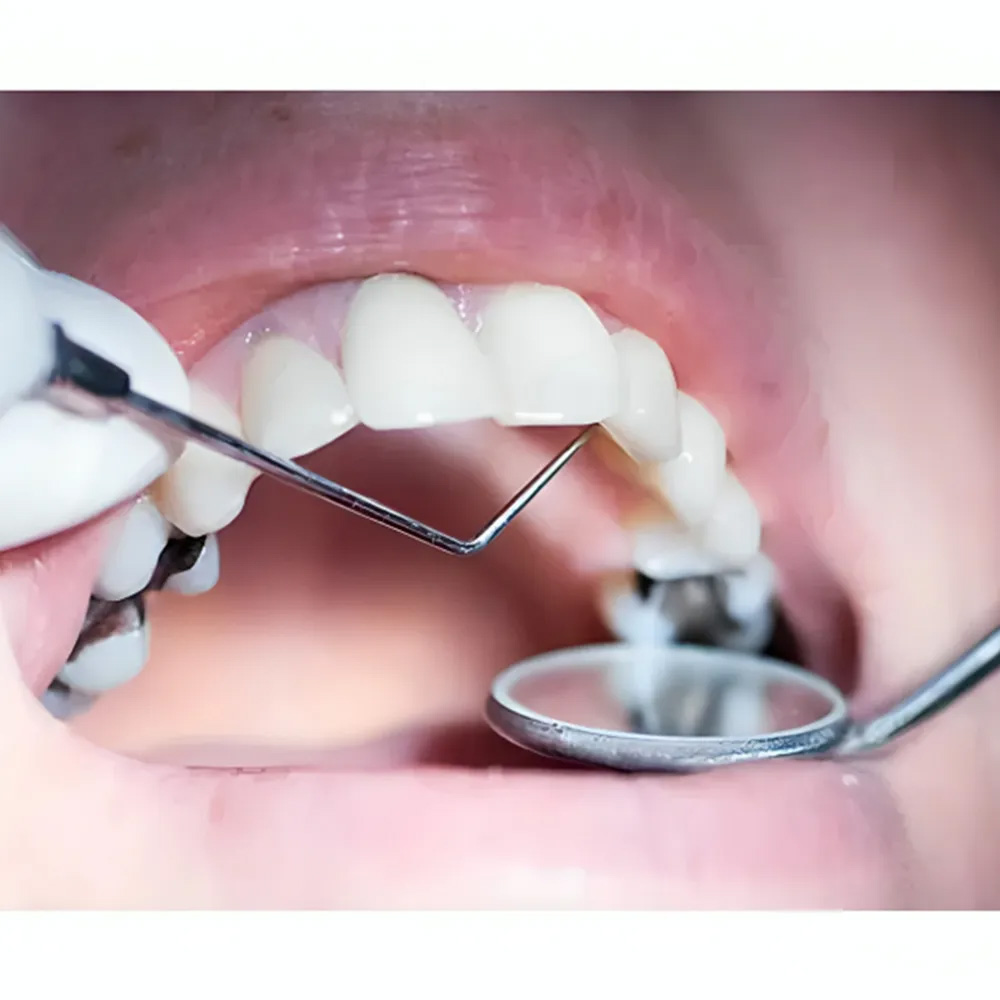 Veecare Conservative Instruments Set of 20