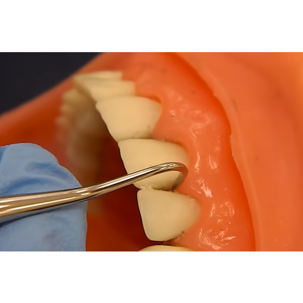 Waldent Sickle Scalers