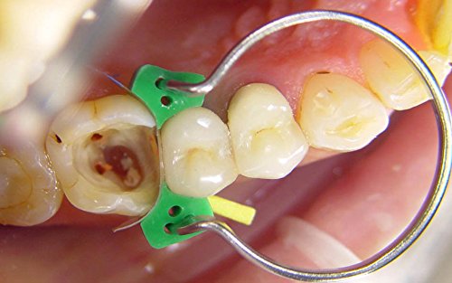 Tor Vm Fixing Kit Delta No. 1.870