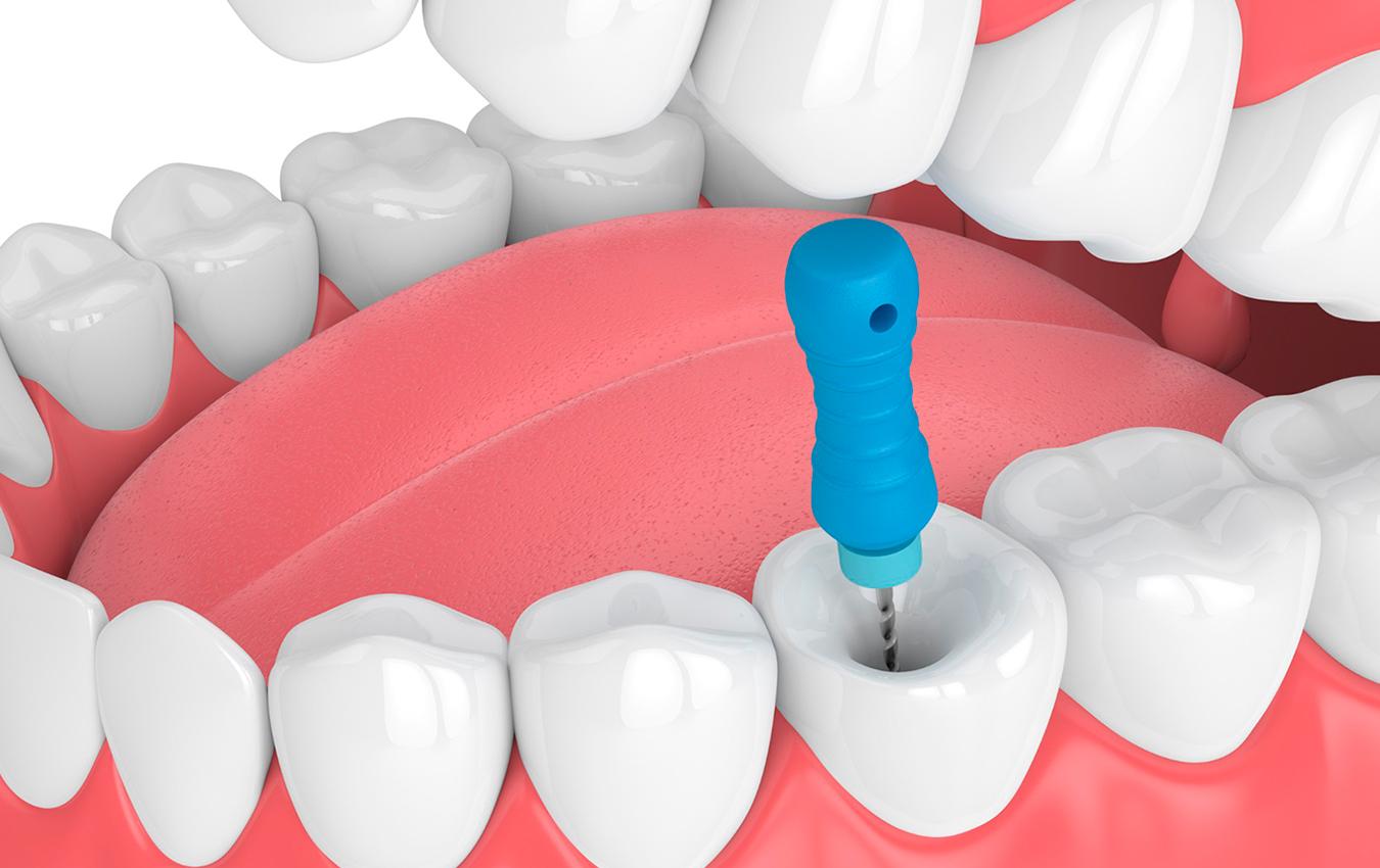 Dentsply Protaper Universal Hand Files 25mm