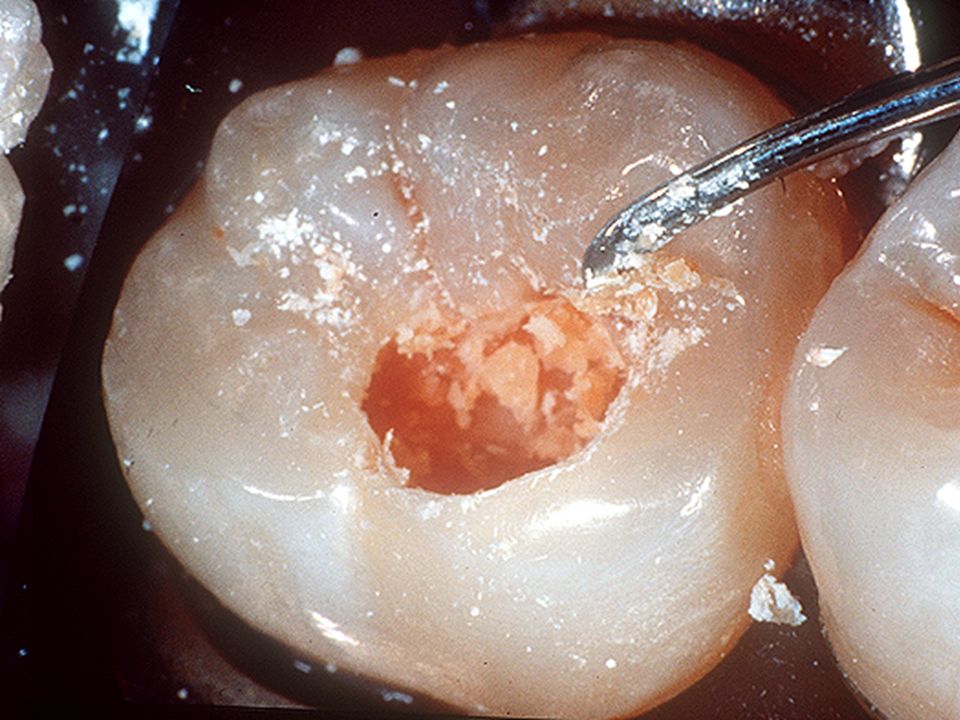 GDC Darby-Perry Spoon Excavator - 3 (EXC212/213)