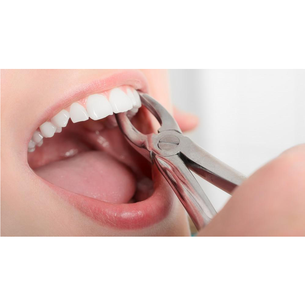 GDC American Extraction Forceps