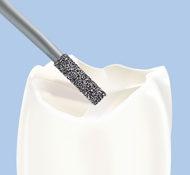 Frank Diamond Bur SF-11 | Made in Germany (Pack of 5)