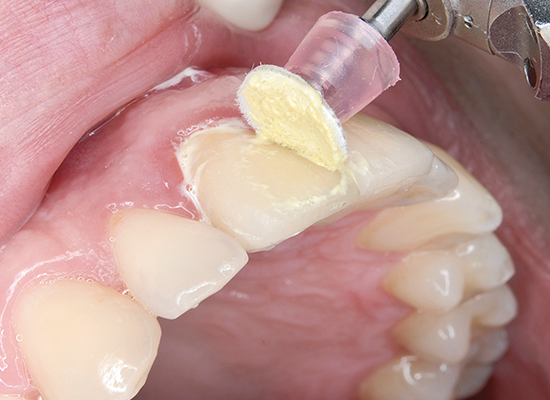 Shofu Super-Snap Buff Mini -Disk (PNL524)