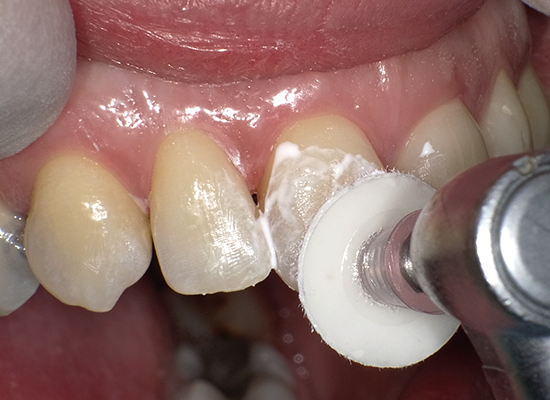 Shofu Super-Snap Buff Mini -Disk (PNL524)