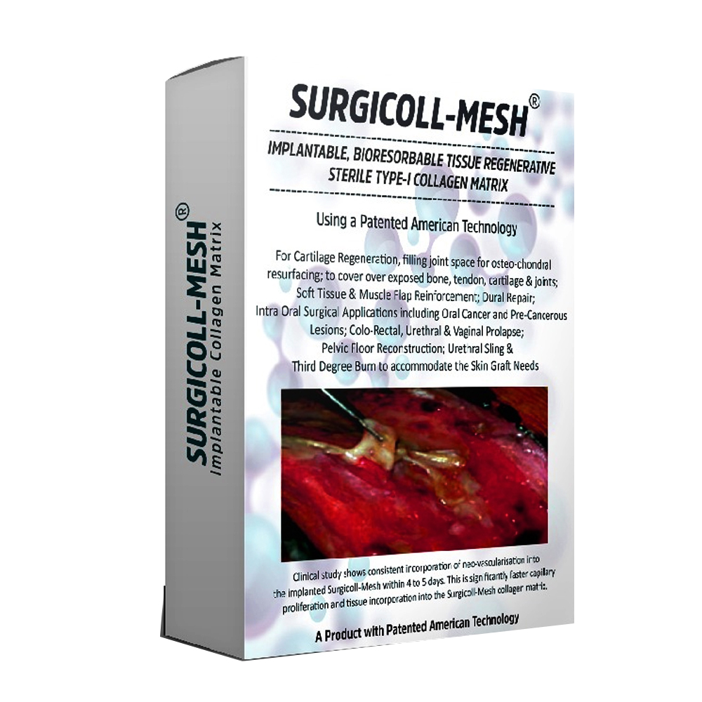 Advance Biotech Surgicoll Mesh 5x5 (8001.B-01)