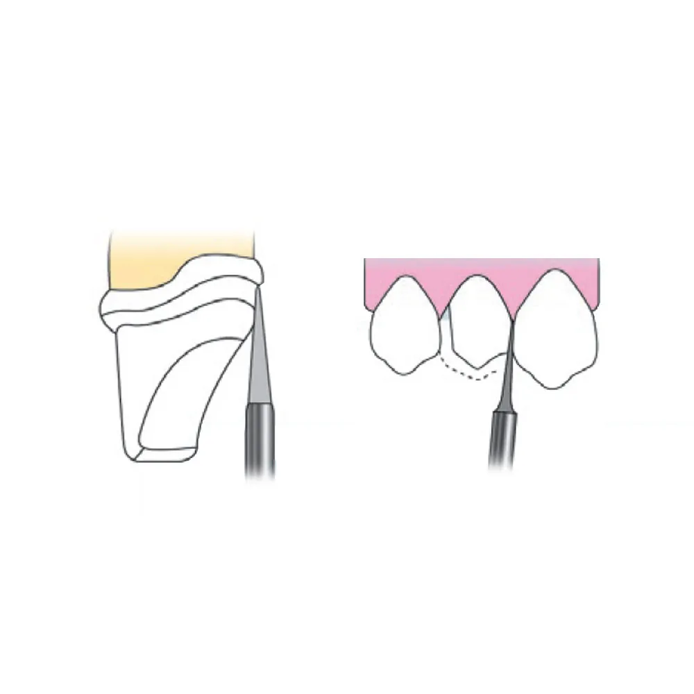 Frank Dental Tapered Cone FG Diamond Burs TC Series ( Extra Fine)