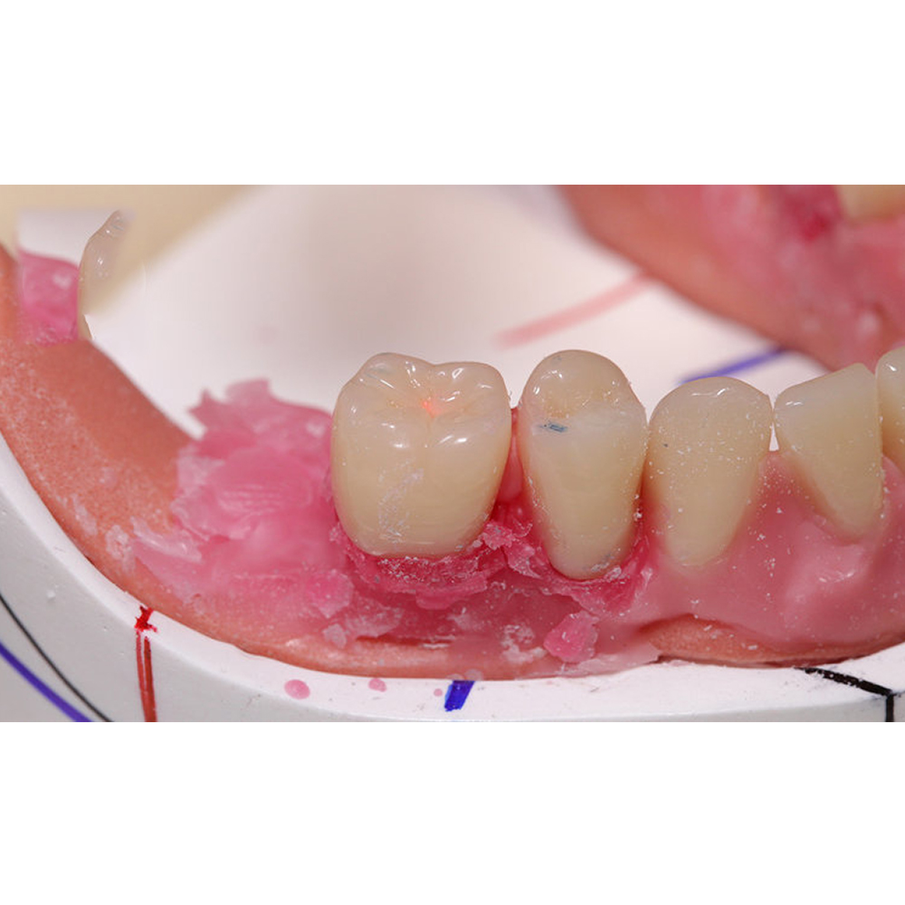 Huge Dental Bluebell Acrylic Denture Teeth A1 (Set of 28)